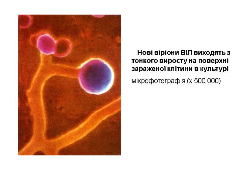 Нові віріони ВІЛ виходять з тонкого виросту на поверхні зараженої клітини в культурі мікрофотографія